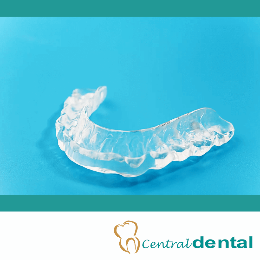 Central-Dental-Occulsal-Splint-night-guard-teeth-grinding-1-2.png